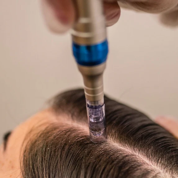 Chayenne (MMP capilar)​